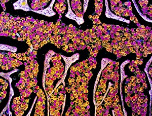 Intestinal Parasites Drucke: Tapeworm proglottid, light micrograph
