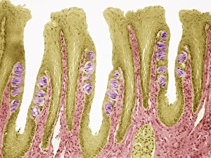 Human Tongue Anatomy Drucke: Taste buds, light micrograph