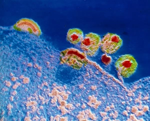 Human Immunodeficiency Virus Drucke: TEM of Aids virus
