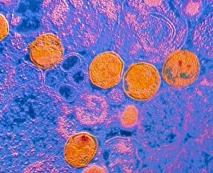 TEM Micrograph Drucke: TEM of Chlamydia sp. spherical bacteria