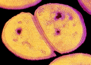 Transmission Electron Microscopy Images Drucke: TEM of dividing staphylococcus aureus