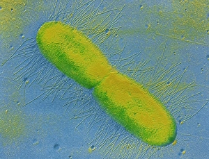 Transmission Electron Microscopy Images Drucke: TEM of E. coli bacterium