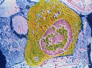 Bilder aus dem Jahr 1989: Templom von menschlichem Plasmozyt