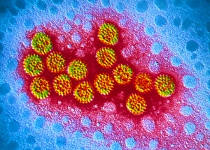 RNA Virus Structure Drucke: TEM of rotavirus particles