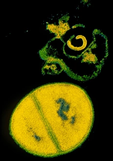 Antibiotic Resistant Bacteria Drucke: TEM Staphylococcus aureus