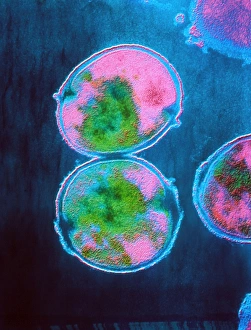 Drucke von Falschfarbendes Transmissionselektronenmikroskopbild von Streptococcus pneumoniae (Pneumokokkus), ein sphaerisches, Gram-positives Bakterium mit Verbindung zur Pneumonie bei Menschen Bilder Datiert 2002 Oktober: Temperatur von Staphylococcus aureus Bakterien