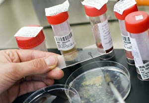 Lung Disease Diagnosis Drucke: Testing sputum for lung diseases