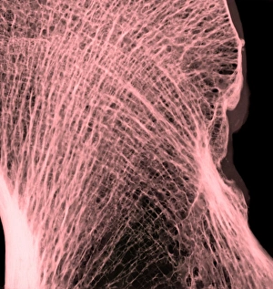 Femur Bone Structure Drucke: Thigh bone head, X-ray
