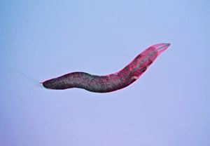Intestinal Parasites Drucke: Threadworm, light micrograph