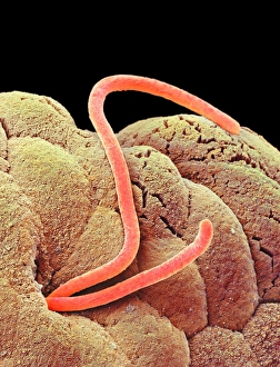 Bilder vom 7. März 2013: Rindernägel im Darm, SEM