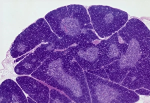 Drucke von Thymus gland. Lichtmikroskopische Abbildung einer Schnittstelle durch Gewebe des Thymusglands, Teil des Lymphsystems. Die dichten Bereiche sind die thymische Cortex, der viel Lympozyten produziert Bilder Datiert 2013 März: Nierenkörperdrüse, Lichtmikroskopie C015/4970