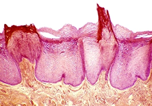 Tongue Anatomy Drucke: Tongue papillae, light micrograph
