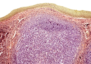 Immune System Cells Drucke: Tonsil, light micrograph