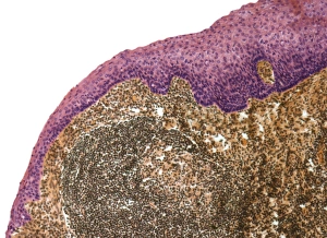 Light Microscopy Images Drucke: Tonsil, light micrograph F006 / 9818