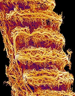 Bilder Datiert 9. September 2004: Trachea