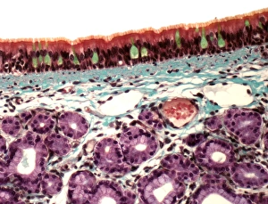 Respiratory System Anatomy Drucke: Trachea, light micrograph