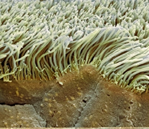 Respiratory Tract Anatomy Drucke: Trachea lining, SEM C013 / 7120