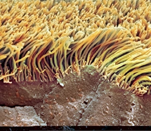 Respiratory Tract Anatomy Drucke: Trachea lining, SEM C013 / 7121