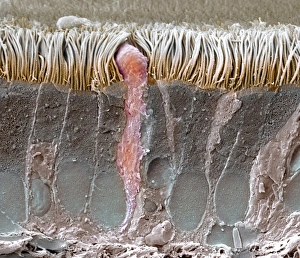 Trachealinnung, SEM C013 / 7122