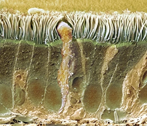 Trachea Lining SEM Drucke: Trachea lining, SEM C013 / 7123