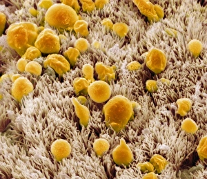 Drucke von Die Schleimhaut der Trachea, farbige Rasterelektronenmikroskopaufnahme (SEM) von der Schleimhaut einer Trachea (Lungenrohr), zeigt die Härchen und Kugelzellen Bilder Datiert 2012 Juli: Rachenlinie, SEM C013/7125