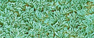 Respiratory Tract Cells Drucke: Trachea lining, SEM C016 / 9755