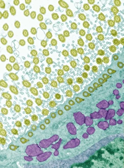 Transmission Electron Microscopy Images Drucke: Trachea lining, TEM C014 / 1472