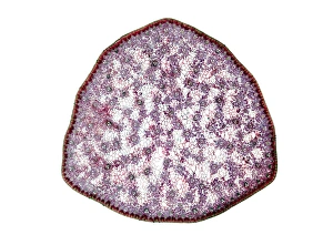 Vascular Bundle Structure Drucke: Umbrella grass stem, light micrograph