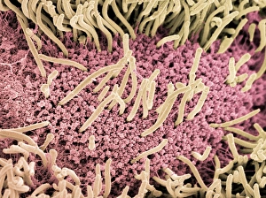 Drucke von Schnecken. Farbige Rastertunnelmikroskopie (SEM) der Unterseite einer Schnecke (Ordnung Gastropoda). Die Unterseite der Schnecke ist mit mikroscopischen Haarähnlichen bekannt als Cilia (gelb) Bilder Datiert 2005 Januar: Unterseite eines Schlangenmühlchens SEM