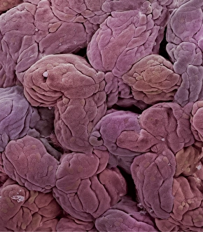 Uterine lining, SEM