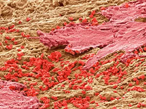 SEM Drucke: Schleimhaut des Uters in der Menstruationszeit, SEM