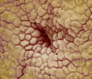Coloured Scanning Electron Microscopy Images Drucke: Uterus lining, SEM