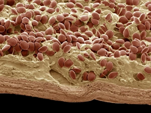Drucke von Vanillekornchen, farbender Scanning electronenmikroskop (SEM). Schnitt durch ein Vanillekernzeichen mit Samenschalen (orange) und Parachymatistoffwechsel Bilder Datiert 2009 Mai: Vanillekornchen, SEM