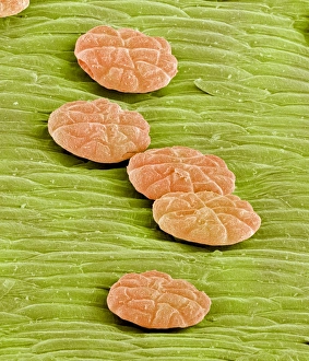 Drucke von Die Verdauungsdrüsen der Venusfliegenfalle (Dionaea muscipula). Farbige Rastertunnelmikroskopaufnahme (SEM) von Verdauungsdrüsen einer Venusfliegenfallepflanze Bilder Datiert 2003 August: Die Verdauungsdrüsen des Venusblumens im SEM
