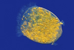 Ciliate Protozoa Drucke: Vorticella protozoan, light micrograph