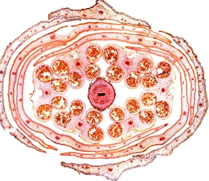 Light Microscopy Images Drucke: Wallflower bud, light micrograph