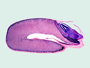Wheat grain, light micrograph