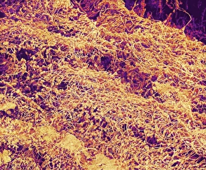 Bilder Datiert 22. August 2002: Weißbrot-Milchkeim, SEM