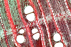 Tree Growth Patterns Drucke: Wood, light micrograph