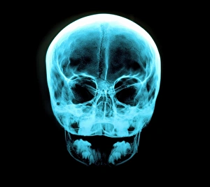 Anatomy Of The Human Head Drucke: X-ray of human skull