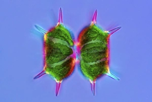 Bilder Datiert 8. März 2013: Xanthidium desmidien, Lichtmikroskop