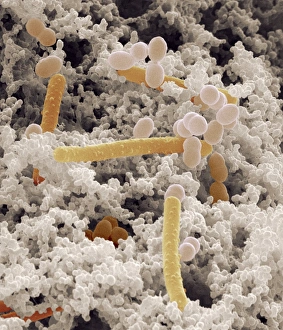 Drucke von Bakterien des Joghurts. Farbener Rasterelektronenmikroskopbild (SEM) von Bakterien (farbig) unter den Milchsäureverdauungsprodukten aus einem Joghurt Bilder Datiert 2003 April: Jogurttrockenbakterien, SEM