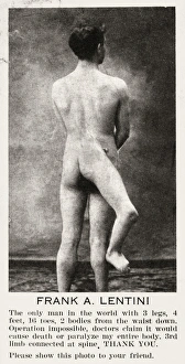Vintage Circus Posters Drucke: THREE-LEGGED MAN, c1915. Pitch card featuring Francesco A