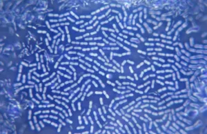 Wissenschaft Drucke: Eine Kolonie Bakterien unter dem Mikroskop gesehen werden können