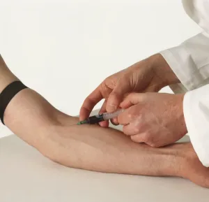 Blood Test Procedure Drucke: Hypodermic needle inserted into forearm