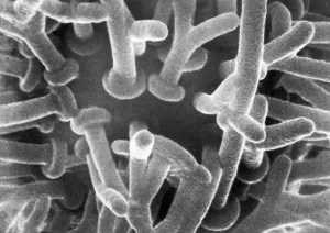 Electron Microscope Images Drucke: Synaptic Knobs First Photographed