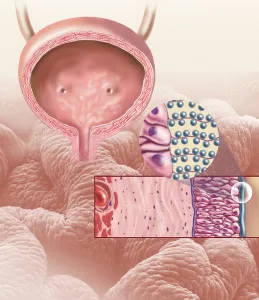Female Reproductive System Anatomy Drucke: Detail of the cellular structure that forms the bladder lining