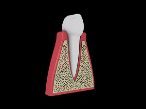 Human Tooth Anatomy Drucke: Conceptual image of human tooth
