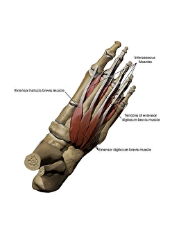 Calcaneus Bone Anatomy Drucke: Human foot showing the dorsal intermediate muscles and bone structures with annotations