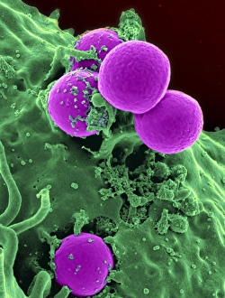 Drucke von Rasterelektronenmikroskopbild eines menschlichen Neutrophils, das sich mit MRSA isst Octodontidae Drucke: Rasterelektronenmikroskopbild eines menschlichen Neutrophils, das MRSA isst